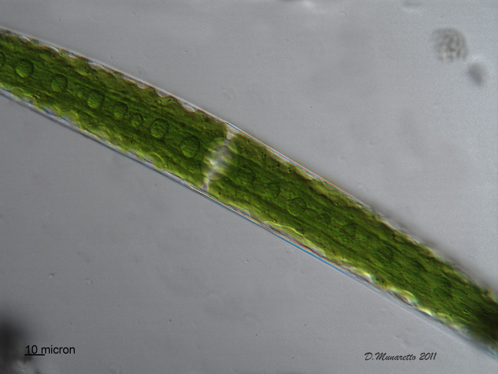 Closterium